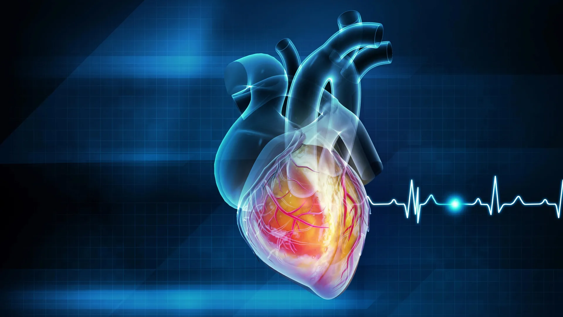 could-a-simple-infection-trigger-a-heart-attack-new-research-reveals-a-shocking-link