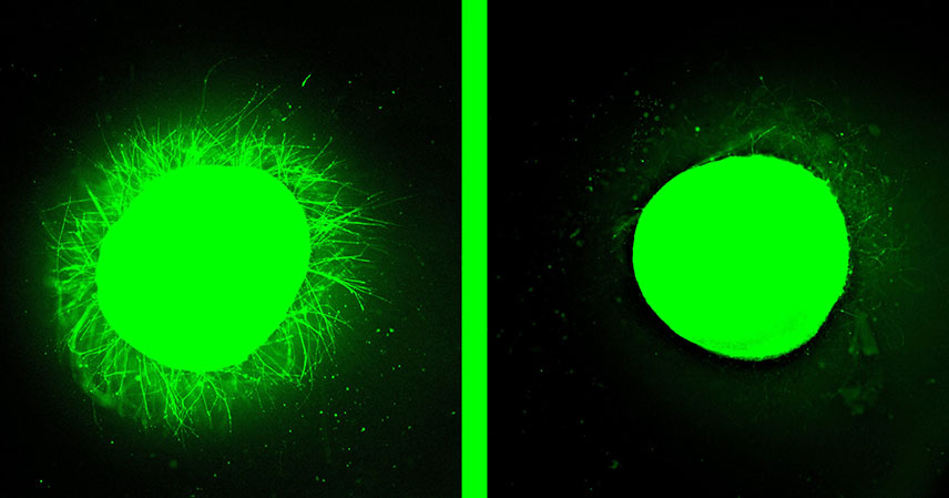 paralysis-treatment-he
